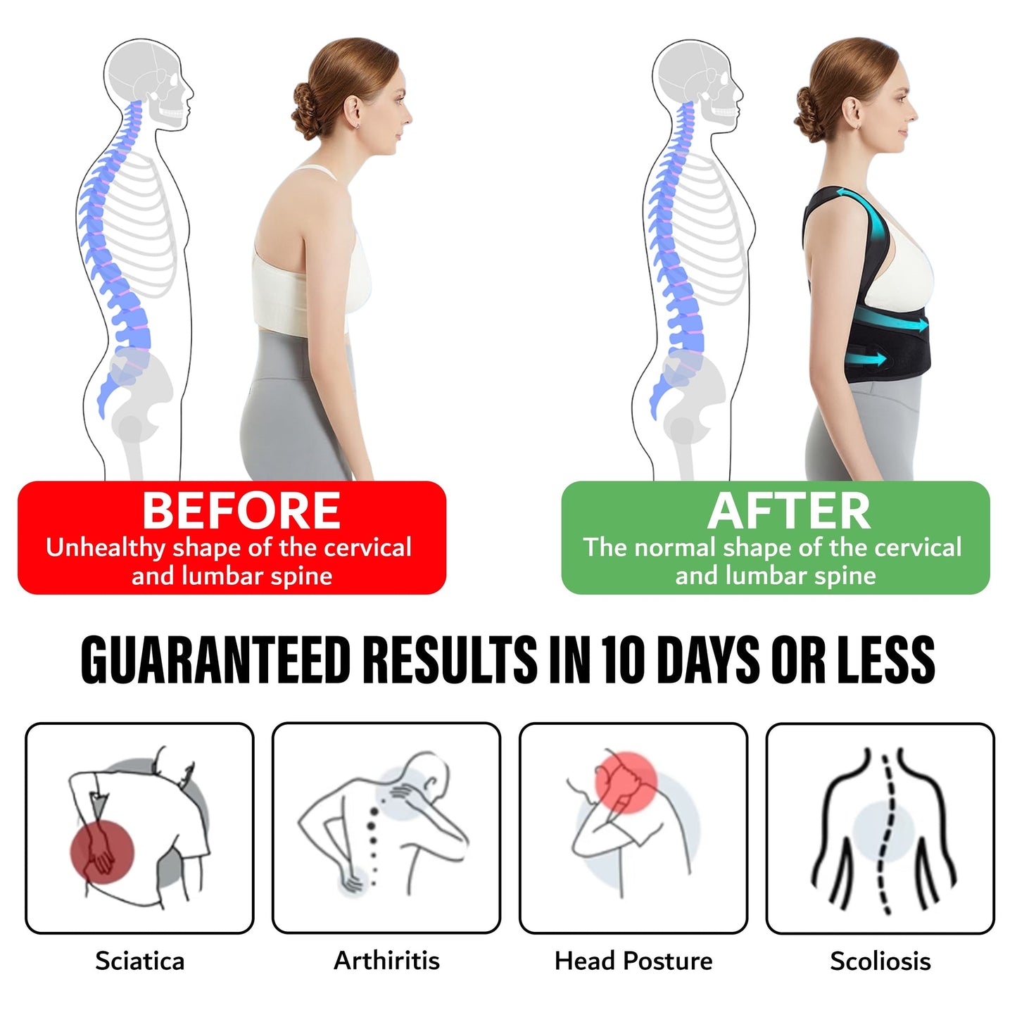 Adjustable Posture Corrector for Back and Shoulder Support